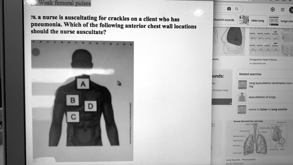 SOLVED: A nurse is auscultating weak femoral pulses. The nurse is also ...