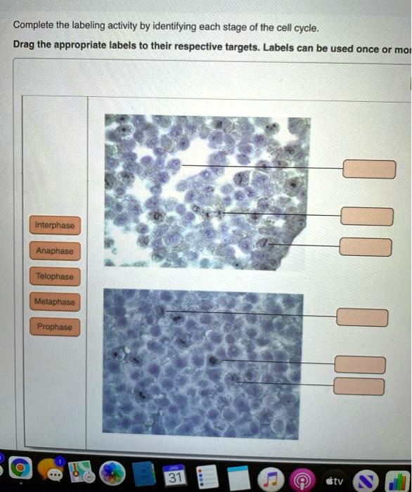 SOLVED: Complete the labeling activity by identifying each stage of the ...