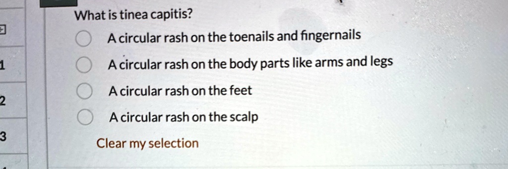 what is tinea capitis a circular rash on the toenails and fingernails a ...