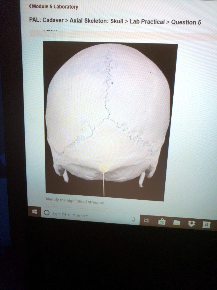 SOLVED Module 5 Laboratory PAL Cadaver Axial Skeleton Skull Lab Practical Question 5