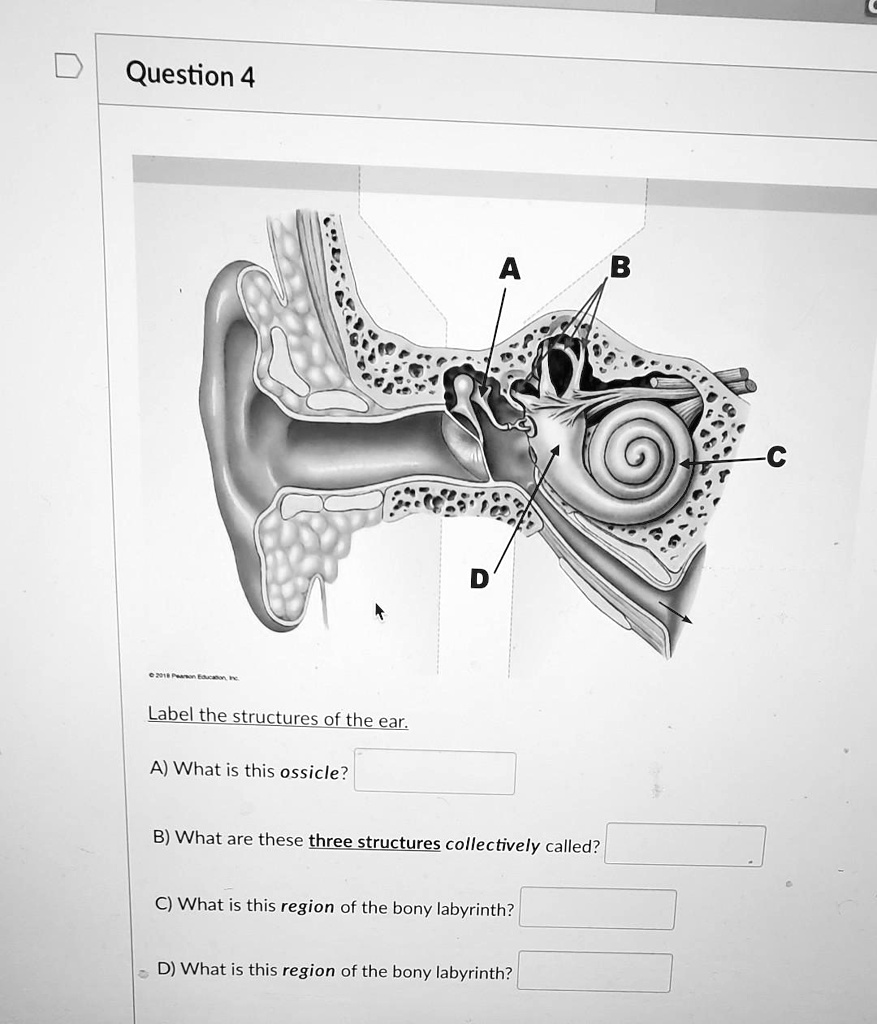 SOLVED: Question 4 A Label the structures of the ear A) What is this ...