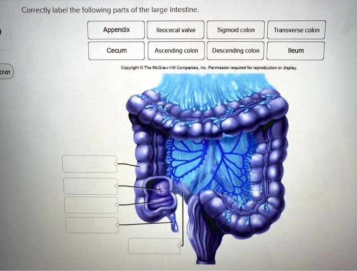 SOLVED: Correctly label the following parts of the large intestine ...