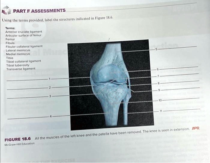 PART F ASSESSMENTS Terms: Anterior cruciate ligament, Articular surface ...