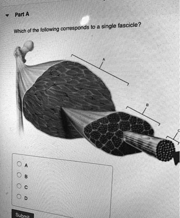 Part A
Which of the following corresponds to a single fascicle?
A
B
C
D
Submit