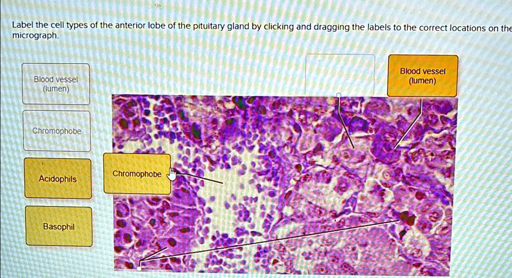 SOLVED: Label the cell types of the anterior lobe of the pituitary ...