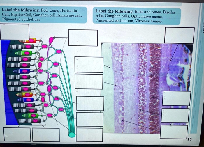SOLVED Label the following Rod, Cone, Horizontal Cell, Ripolar CeU