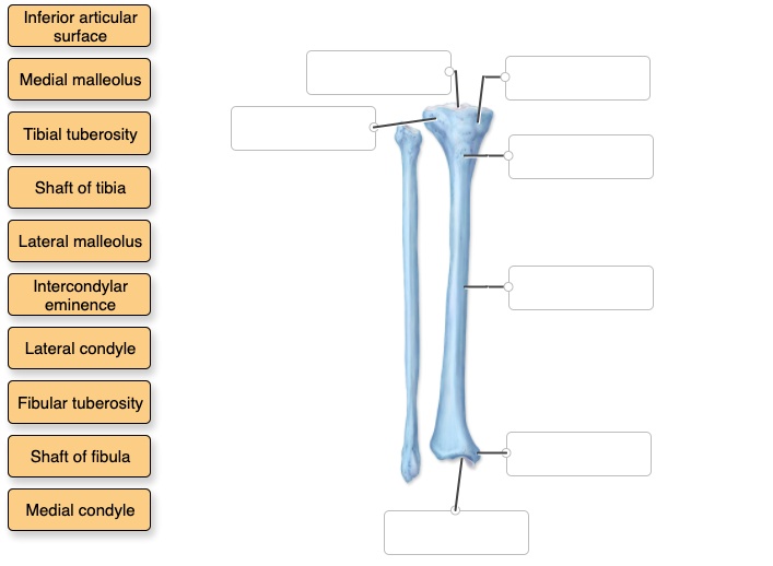 SOLVED: Inferior articular surface Medial malleolus Tibial tuberosity ...