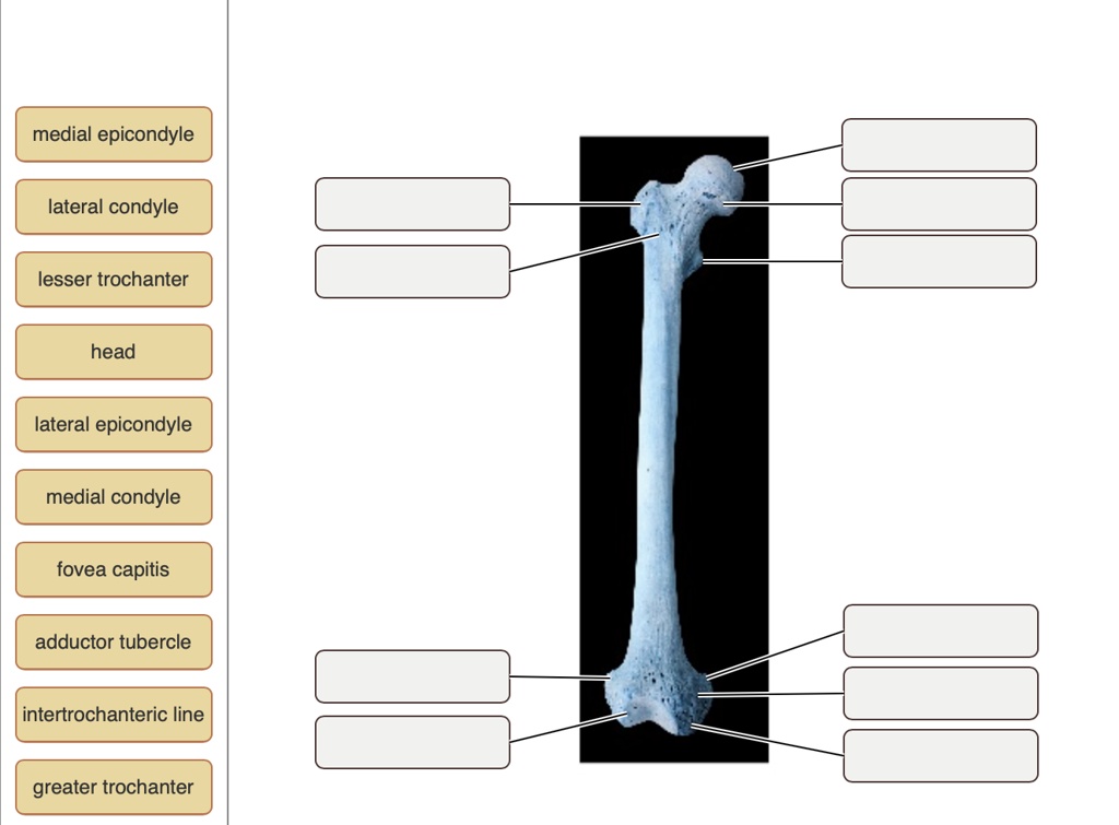 SOLVED: Medial epicondyle Lateral condyle Lesser trochanter Head ...