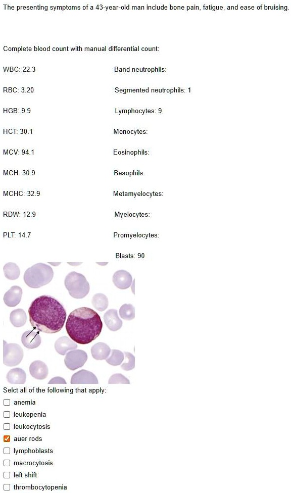The presenting symptoms of a 43yearold man include bone pain, fatigue