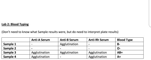 Lab 2: Blood Typing (Don't need to know what Sample results were, but ...