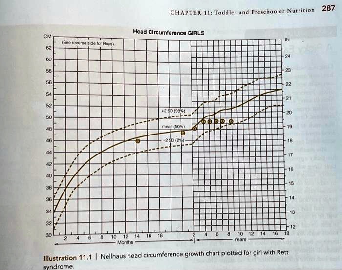 Who Head Circumference Growth Chart
