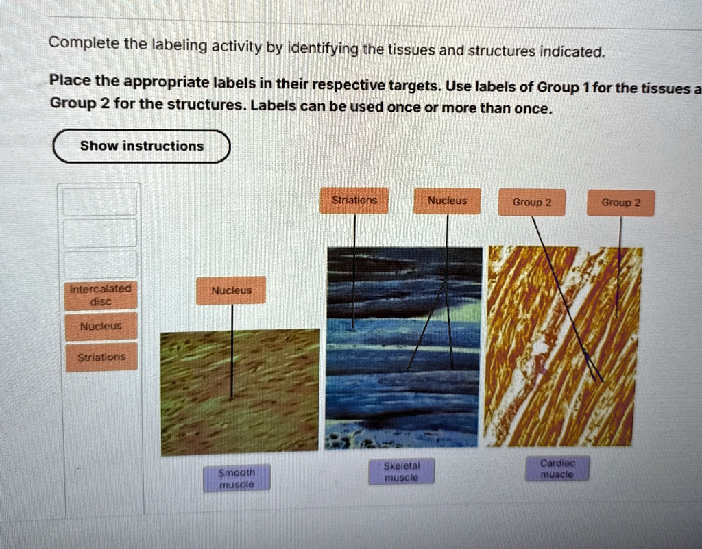 [GET ANSWER] complete the labeling activity by identifying the tissues ...