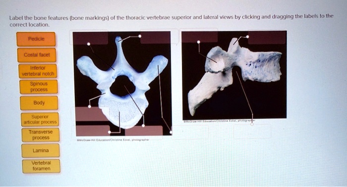 label the bone features bone markings of the thoracic vertebrae ...