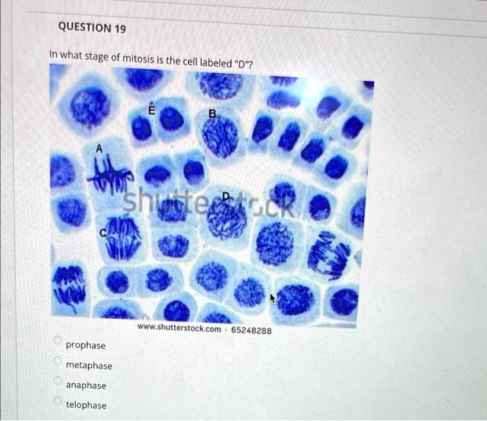 QUESTION 19
In what stage of mitosis is the cell labeled "D"?
prophase
metaphase
anaphase
telophase