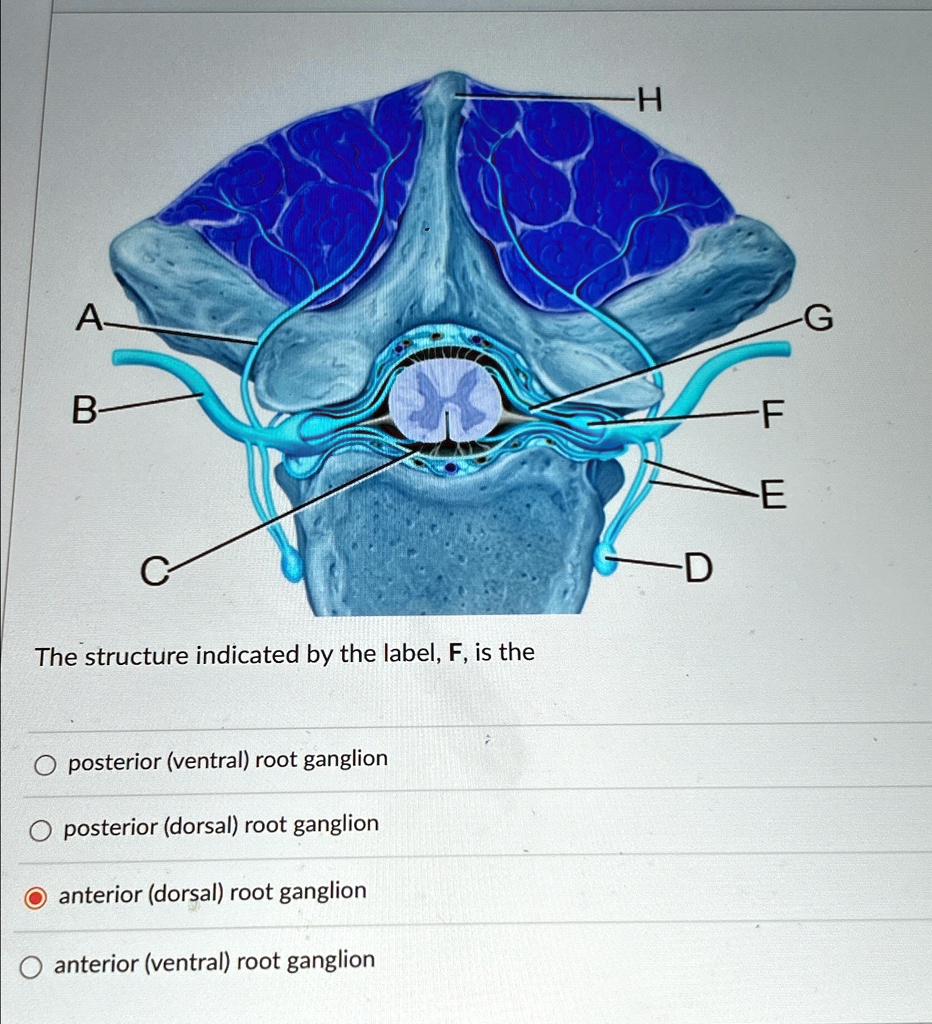 The structure indicated by the label, F, is the posterior (ventral ...