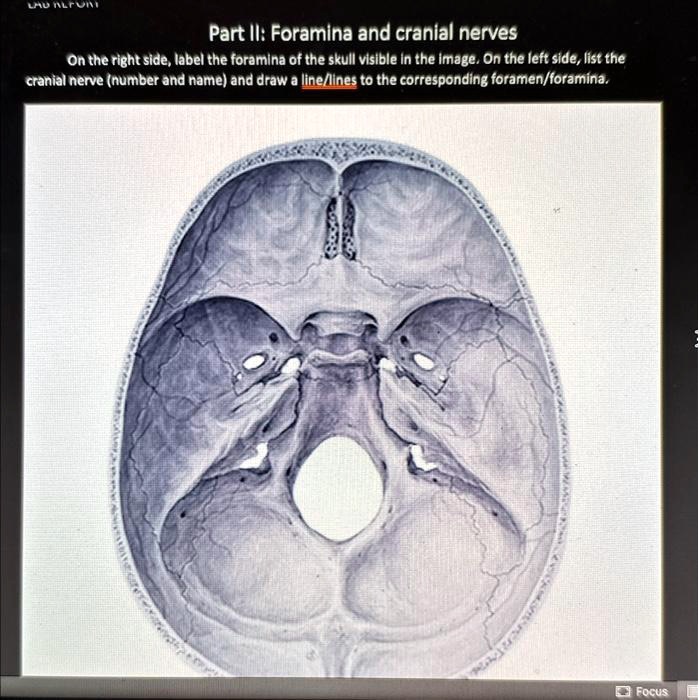 Solved: On The Right Side, Label The Foramina Of The Skull Visible In 