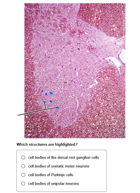 Which structures are highlighted? cell bodies of the dorsal...