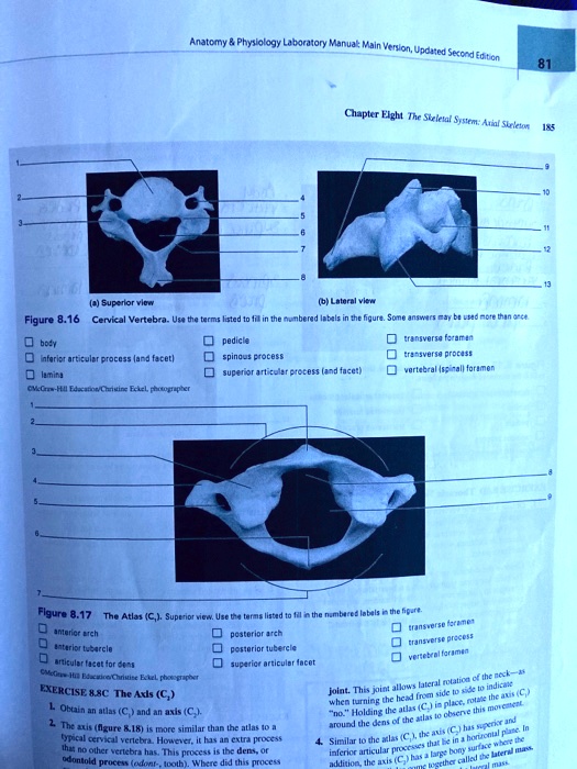 Chapter Eight The Skeletal System: Axial Skeleton
(a) Superior view
(b) Lateral view
Figure 8.16 Cervical Vertebra. Use the terms listed to fill in the numbered labels in the figure. Some answers may be used more than once.
body
pedicle
transverse foramen
inferior articular process (and facet)
spinous process
transverse process
lamina
superior articular process (and facet)
vertebral (spinal) foramen
McGraw-Hill Education/Christine Eckel, photographer
Figure 8.17 The Atlas (C1). Superior view. Use the terms listed to fill in the numbered labels in the figure.
anterior arch
posterior arch
transverse foramen
anterior tubercle
posterior tubercle
transverse process
articular facet for dens
superior articular facet
vertebral foramen
McGraw-Hill Education/Christine Eckel, photographer
EXERCISE 8.8C The Axis (C2)
1. Obtain an atlas (C1) and an axis (C2).
2. The axis (figure 8.18) is more similar than the atlas to a typical cervical vertebra. However, it has an extra process that no other vertebra has. This process is the dens, or odontoid process (odont-, tooth). Where did this process
Joint. This joint allows lateral rotation of the neck-as when turning the head from side to side to indicate "no." Holding the atlas (C1) in place, rotate the axis (C2) around the dens of the atlas to observe this movement.
4. Similar to the atlas (C1), the axis (C2) has superior and inferior articular processes that lie in a horizontal plane. In addition, the axis (C2) has a large bony surface where the