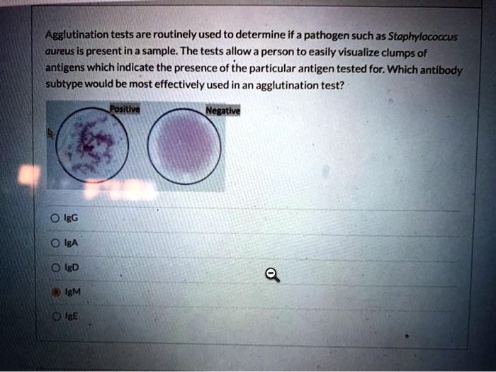 Agglutination tests are routinely used to determine if a pathogen such ...