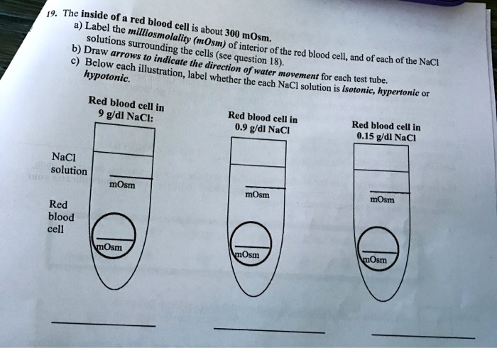19. The inside of a red blood cell is about 300 mOsm.
a) Label the milliosmolality (mOsm) of interior of the red blood cell, and of each of the NaCl solutions surrounding the cells (see question 18).
b) Draw arrows to indicate the direction of water movement for each test tube.
c) Below each illustration, label whether the each NaCl solution is isotonic, hypertonic or hypotonic.

Red blood cell in 9 g/dl NaCl:
NaCl solution  mOsm
Red blood cell  mOsm

Red blood cell in 0.9 g/dl NaCl
 mOsm
 mOsm

Red blood cell in 0.15 g/dl NaCl
 mOsm
 mOsm