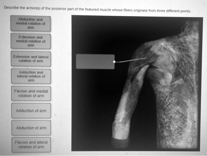SOLVED Describe the actions of the posterior part of the featured