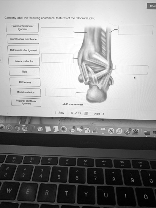 Master The Talocrural Joint Label The Structures Now - 9rgzrun
