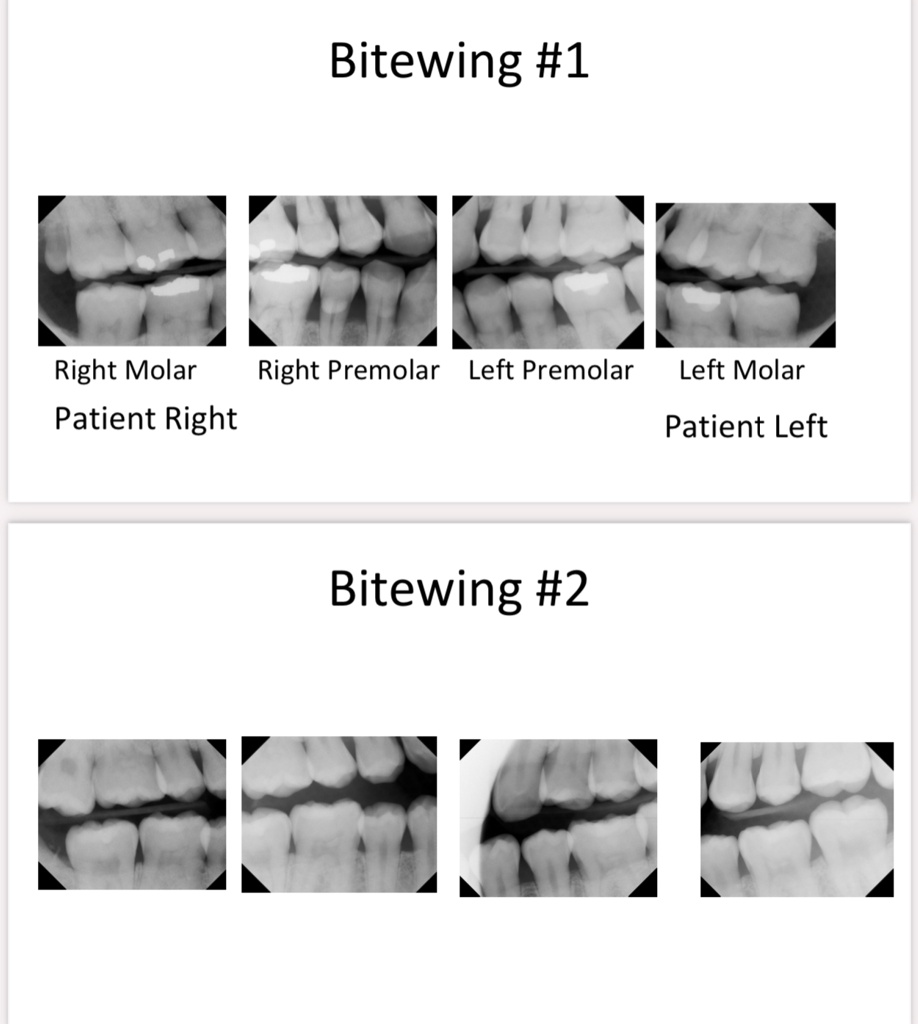 SOLVED Texts What are the errors in these Xrays and how do you