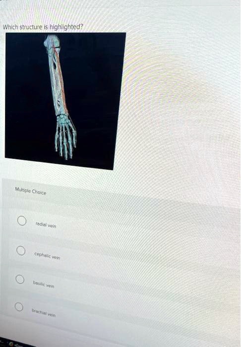 SOLVED: Which structure is highlighted? Multiple Choice radial