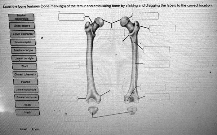 SOLVED: Label the bone features (bone markings) of the femur and ...