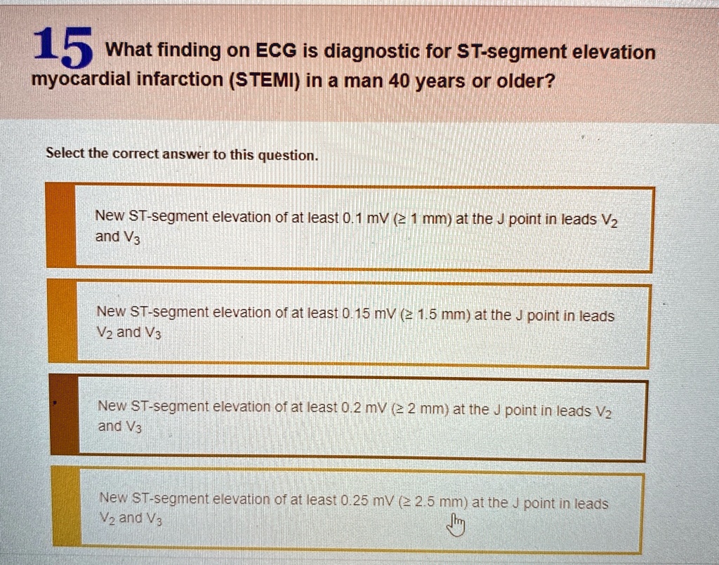 15 what finding on ecg is diagnostic for st segment elevation ...