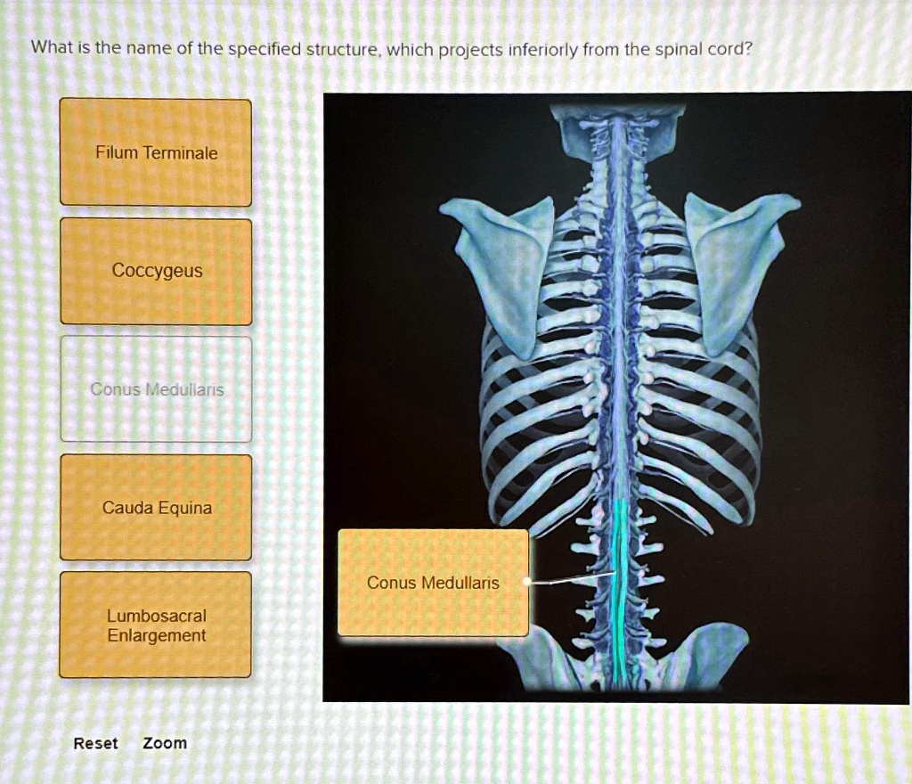 SOLVED: What is the name of the specified structure, which projects ...