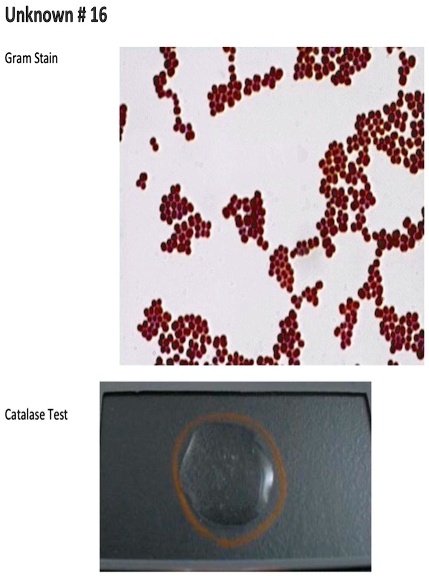 unknown 16 gram stain 1 catalase test 16966
