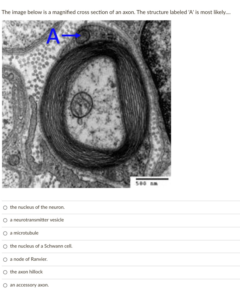 Solved: The Image Below Is A Magnified Cross Section Of An Axon. The 