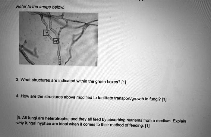 Refer to the image below.
3. What structures are indicated within the green boxes? [1]
4. How are the structures above modified to facilitate transport/growth in fungi? [1]
5. All fungi are heterotrophs, and they all feed by absorbing nutrients from a medium. Explain why fungal hyphae are ideal when it comes to their method of feeding. [1]