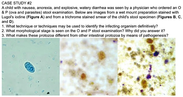 SOLVED: CASE STUDY #2: A child with nausea, anorexia, and explosive ...