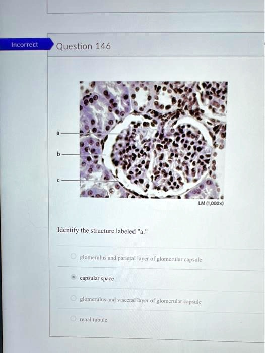 SOLVED: Question 146 LM(1,000) Identify the structure labeled a ...