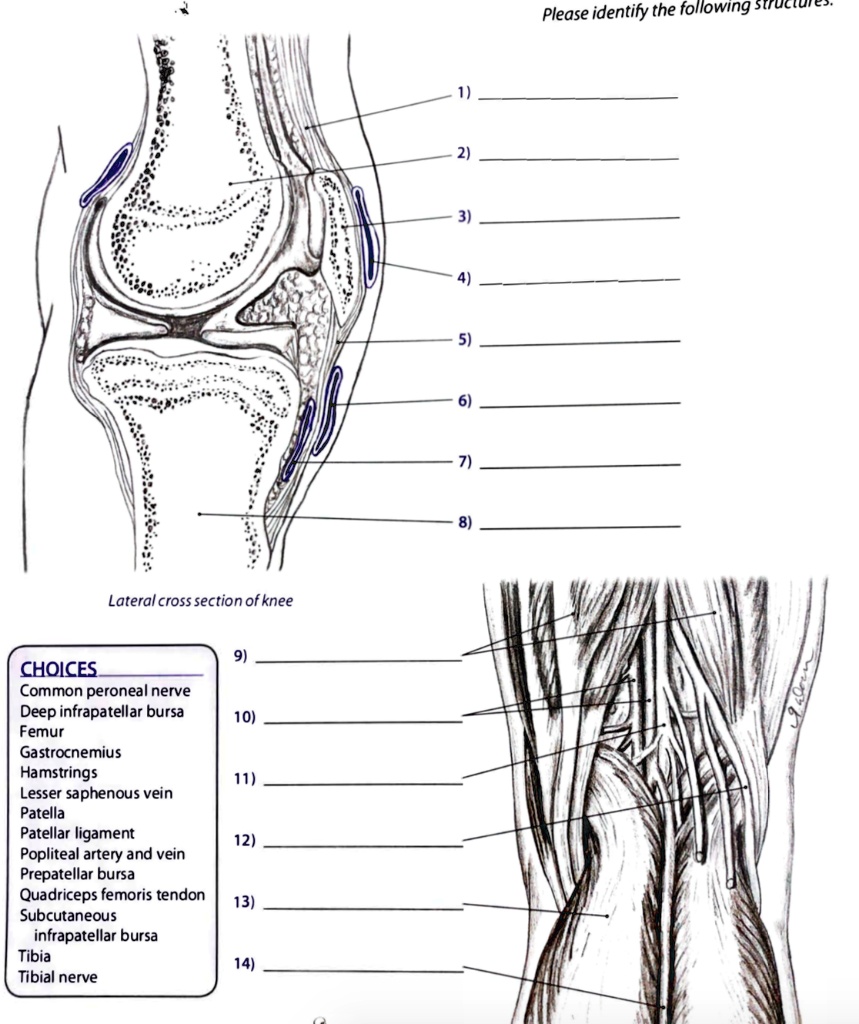 Please identify the following structures in the lateral cross-section ...