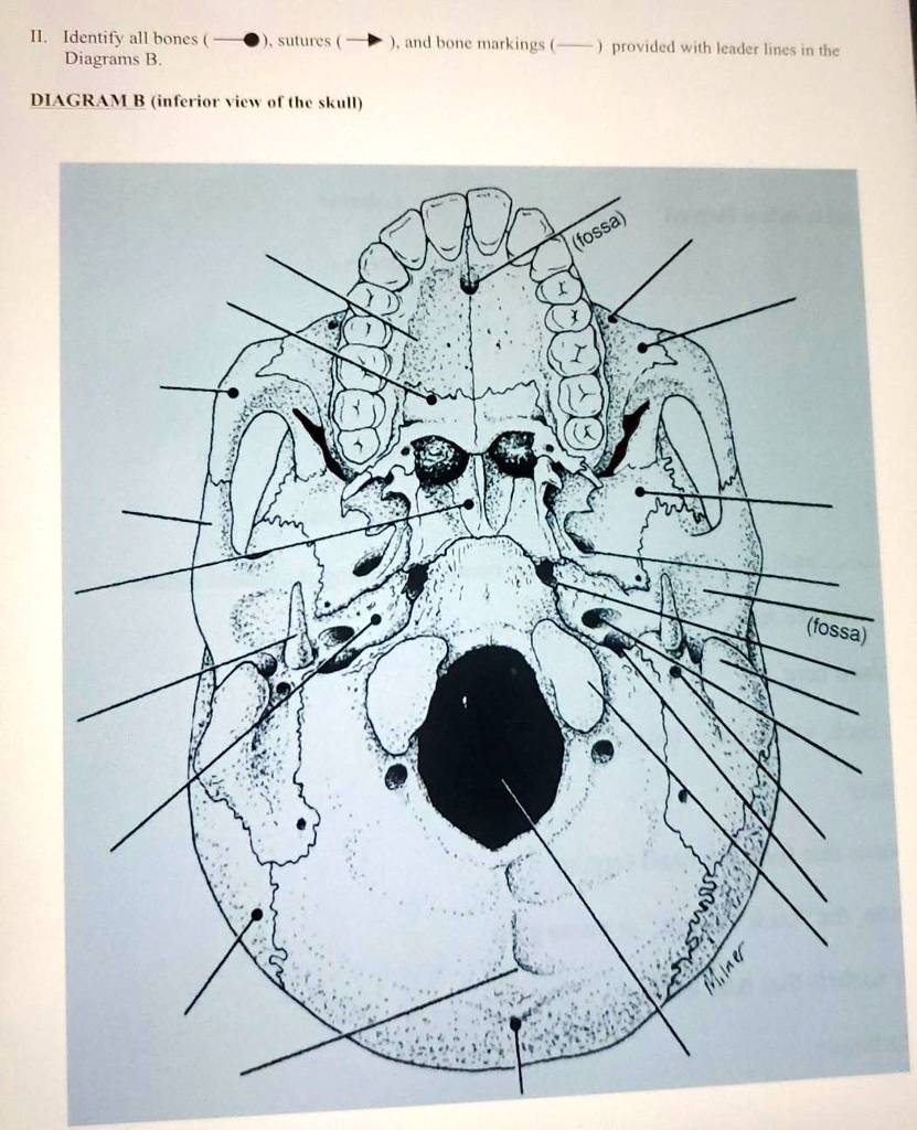 SOLVED: Identify All Bones Diagrams B Suluies A Honle Markings Provided ...