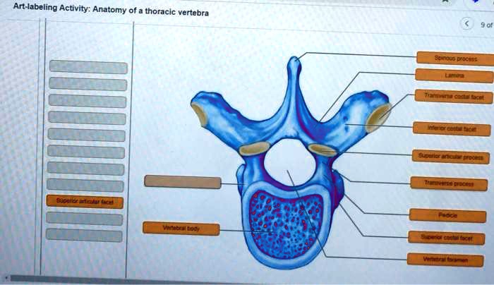 SOLVED: Art-labeling Activity: Anatomy of a Thoracic Vertebra