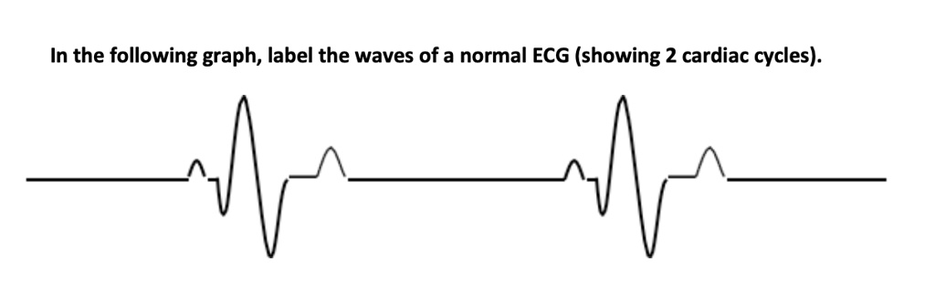 Wave Graph Labeks In the following graph, label the waves of a normal ECG (showing 2 ...