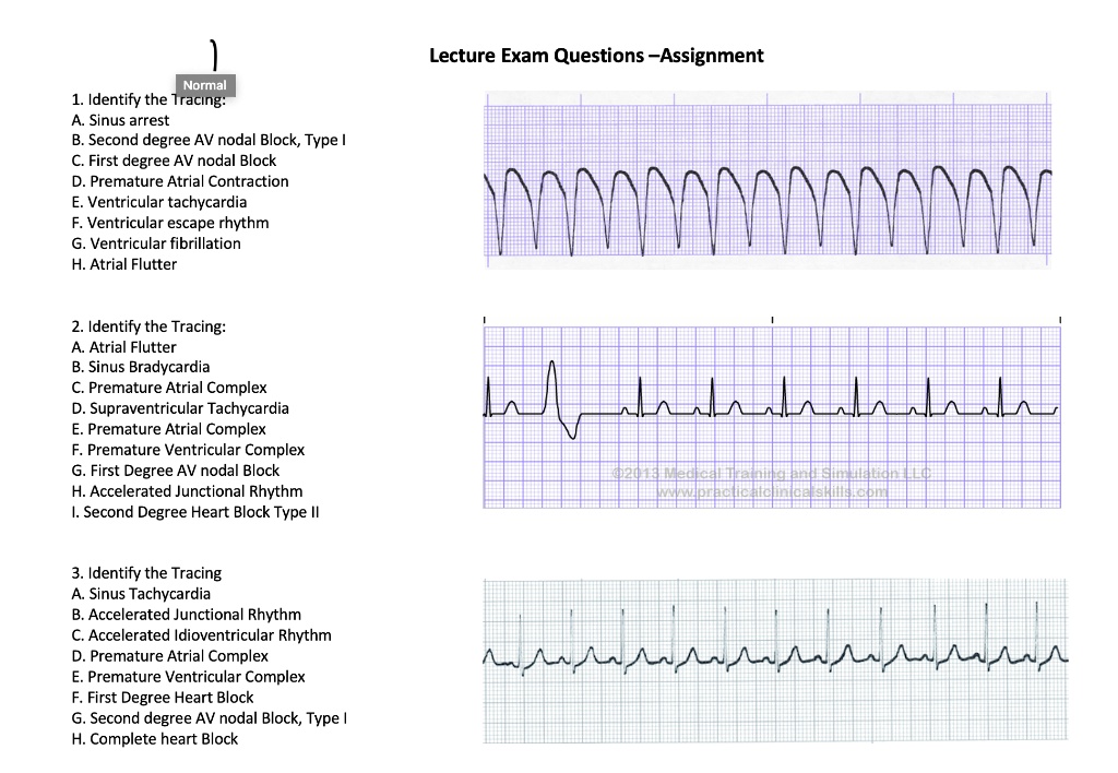 SOLVED: Lecture Exam Questions - Assignment 1. Identify the Tracing: A ...