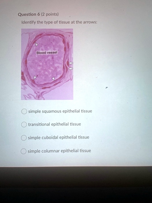Transitional Vs Simple Columnar SOLVED: Question 6 (2 points) Identify the type of tissue at the arrows ...