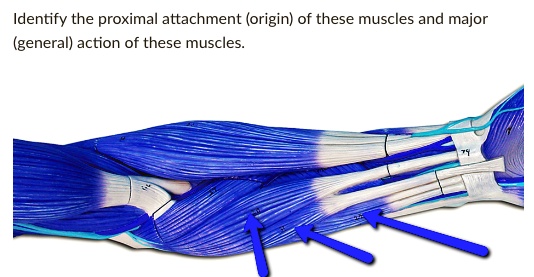 Proximal Muscle Example Identify the proximal attachment (origin) of these muscles...