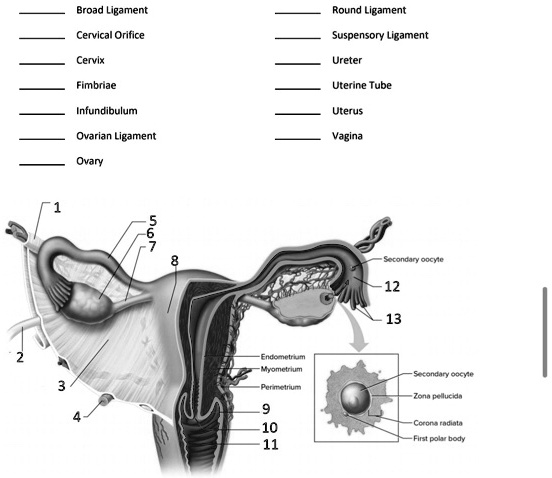 SOLVED: Broad Ligament Round Ligament Cervical Orifice Suspensory ...