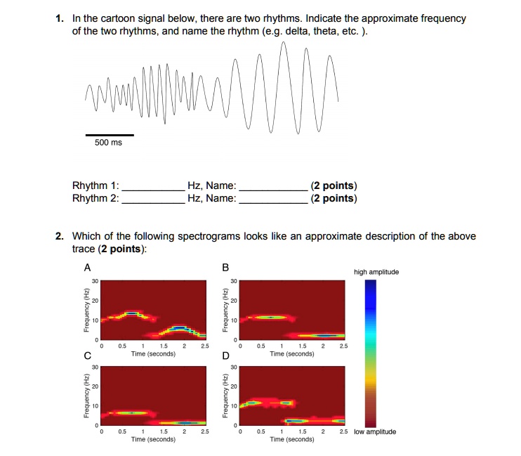 SOLVED:In the cartoon signal below, there are two rhythms Indicate the ...
