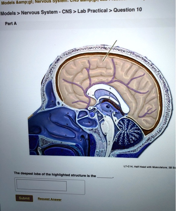 SOLVED: Models > Nervous System > CNS > Lab Practical > Question 10 ...