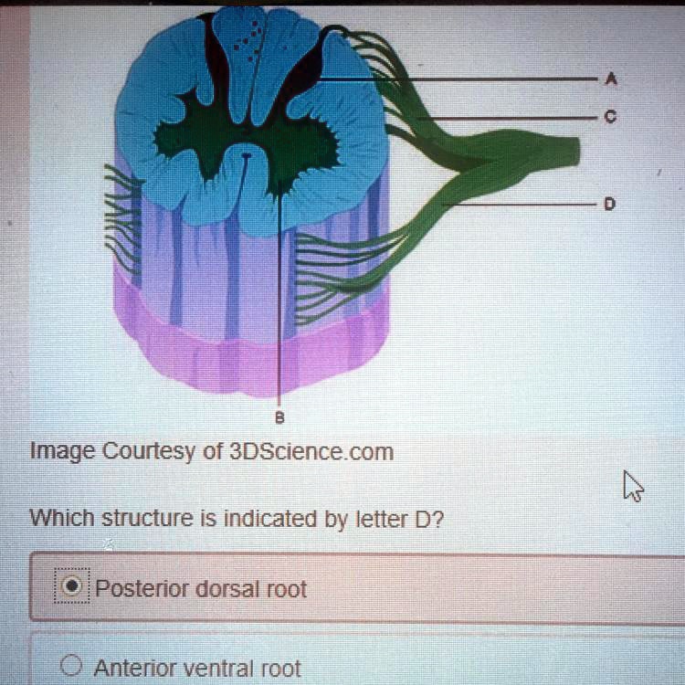 SOLVED Which structure is indicated by letter D? Posterior dorsal