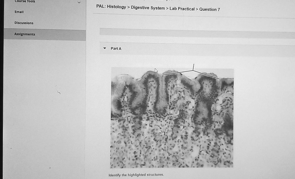 SOLVED course Tools PAL Histology > Digestive System > Lab Practical
