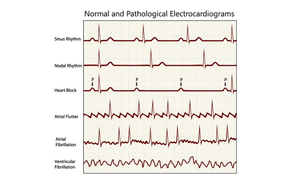 Use the information presented in the Exploration section and Figure 8 ...