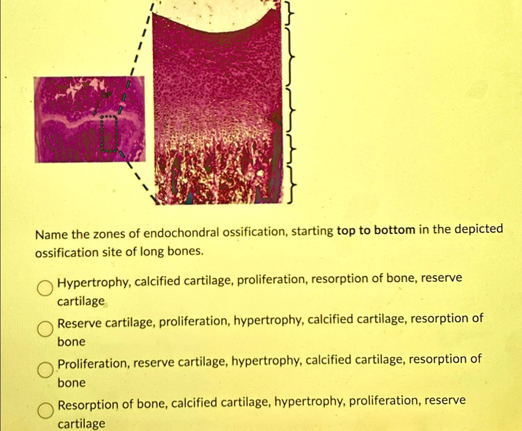 VIDEO solution: Name the zones of endochondral ossification, starting ...